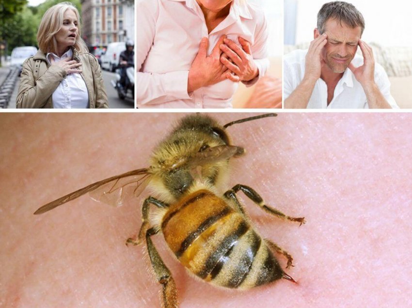 Пчелиный укус вред и польза thumbnail