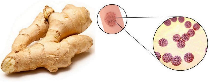Корінь імбиру від папілом Корінь імбиру від папілом