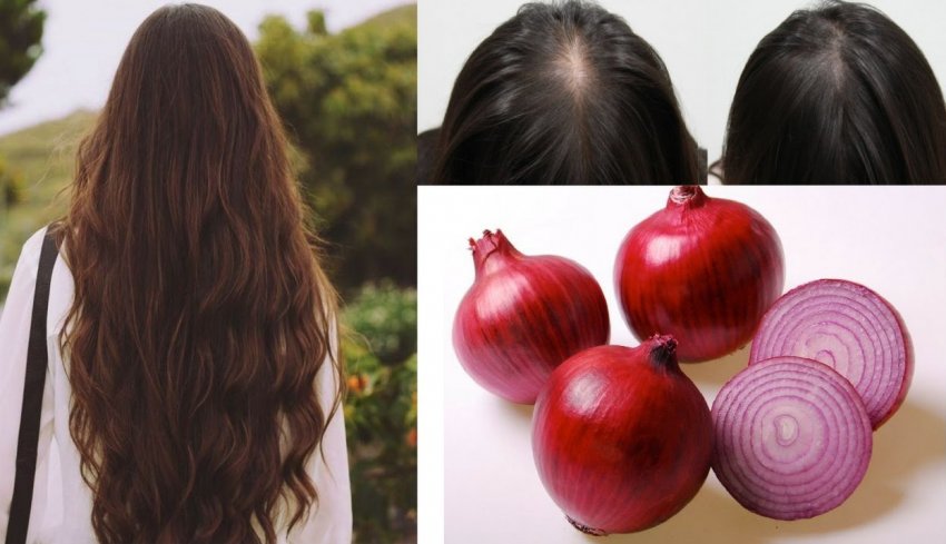 Цибульна маска для волосся Цибульна маска для волосся
