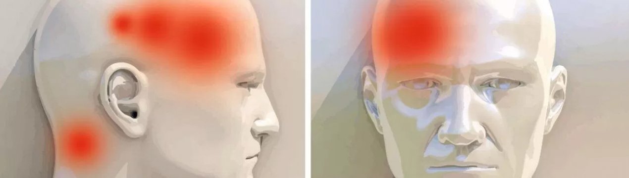 Корінь імбиру від болю в голові: допомагає чи, правила застосування