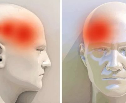 Корінь імбиру від болю в голові: допомагає чи, правила застосування