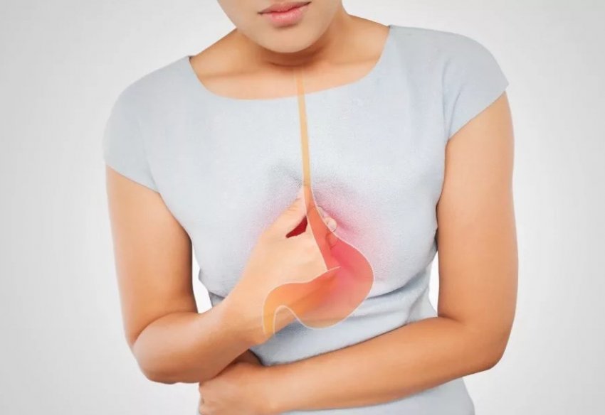 Ижога Ижога