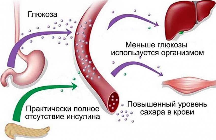 Красная чечевица при диабете 2 типа thumbnail