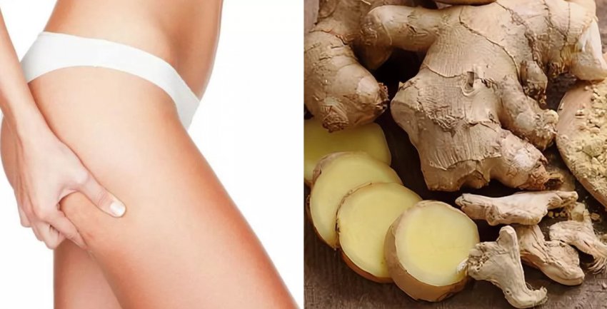 Імбир при боротьбі з целюлітом Імбир при боротьбі з целюлітом