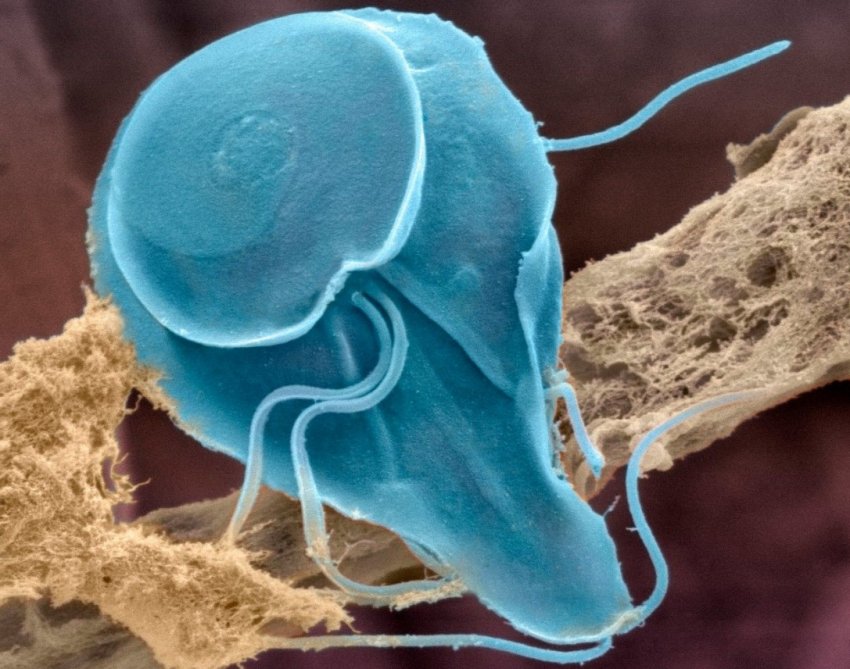 Лямблії Лямблії