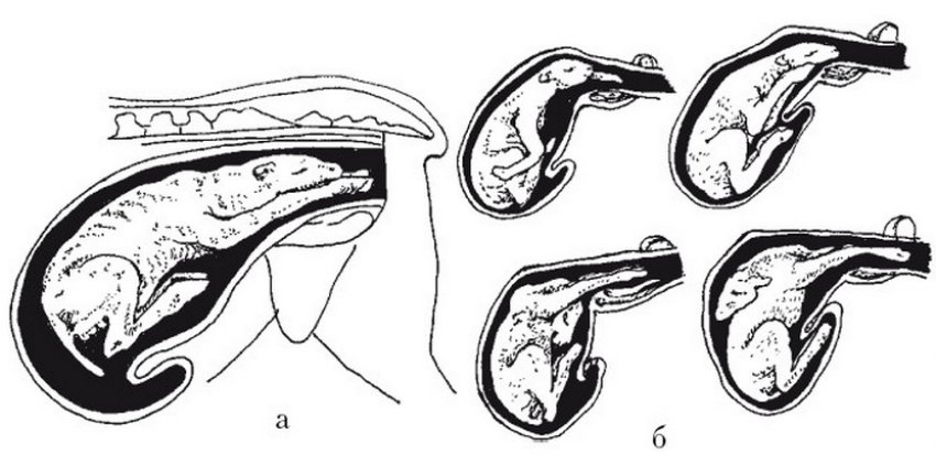 Положення плода під час пологів Положення плода під час пологів