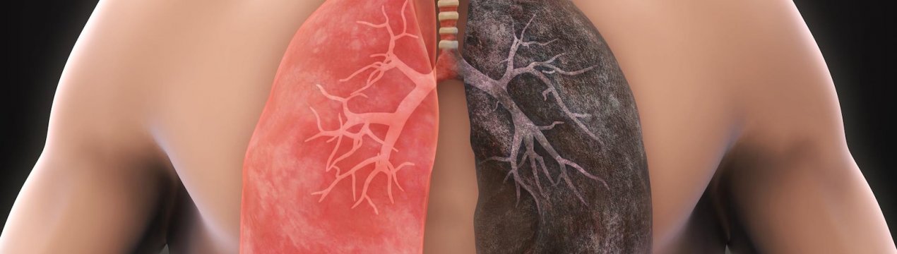 Очищення легенів сумішшю імбиру з куркумою