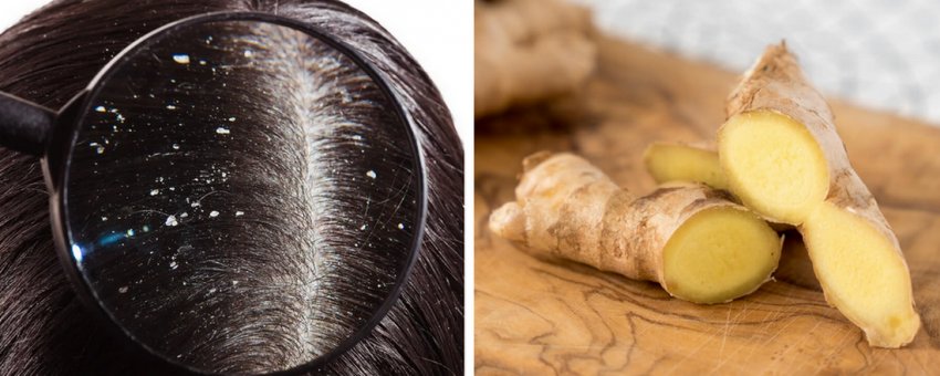 Корінь імбиру від лупи