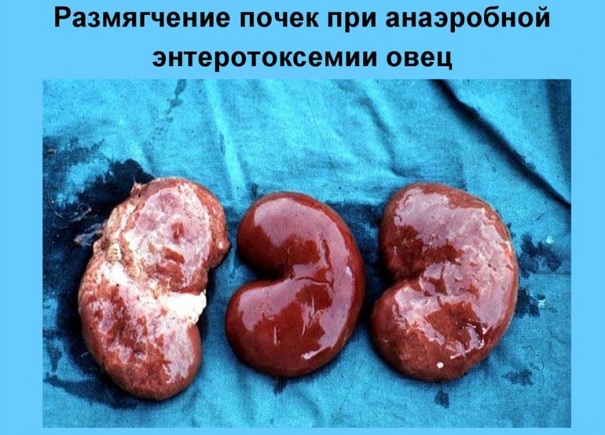 Ентеротоксемія печінки у овець Ентеротоксемія печінки у овець