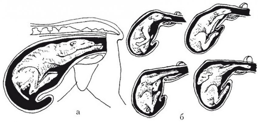 Положення плода