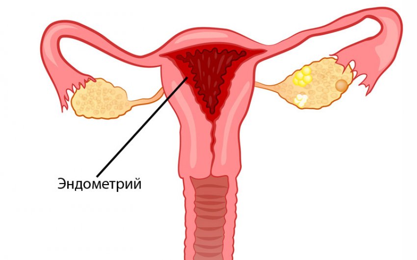 Женские эндометрии