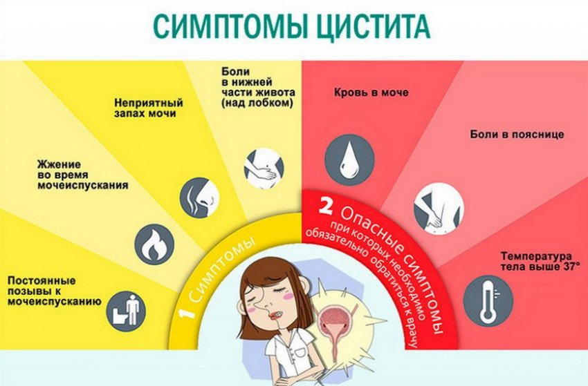 Цистит Цистит
