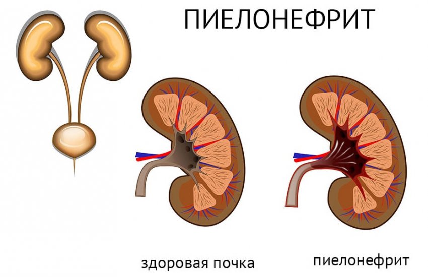 Польза и вред от морса из черной смородины. 95656.ptpor0.850. Польза и вред от морса из черной смородины фото. Польза и вред от морса из черной смородины-95656.ptpor0.850. картинка Польза и вред от морса из черной смородины. картинка 95656.ptpor0.850. Что собой представляет замороженная черная смородина, полезные свойства ее по своим потребительским характеристиками ничем не уступают свежим плодам? В ягодах практически полностью сохраняются вкусовые качества, они богаты ценными веществами и витаминами. Чтобы смородина приносила пользу, а не вред, важно знать какое воздействие она оказывает на организм человека.