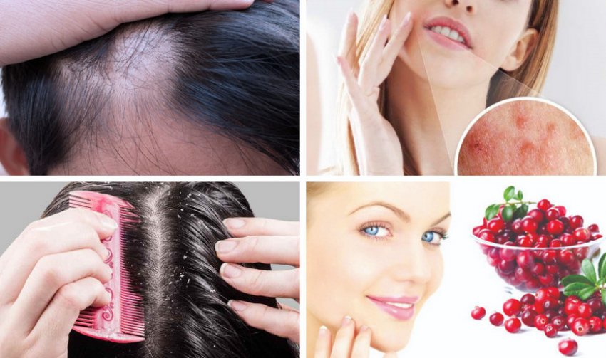 Брусниця в косметології